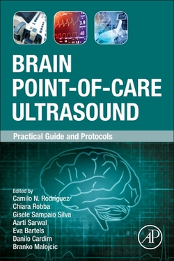 Brain Point-Of-Care Ultrasound|Camilo N. Rodríguez