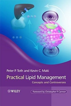 Practical Lipid Management|Peter P. Toth