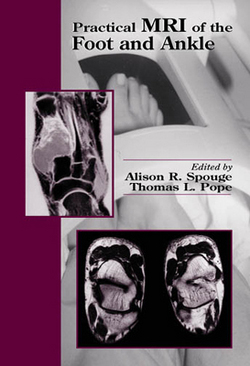 Practical MRI of the Foot and Ankle|Alison R. Spouge