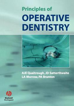 Principles of Operative Dentistry|Qualtrough