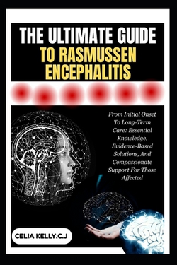 The Ultimate Guide to Rasmussen Encephalitis|Celia Kelly C. J.