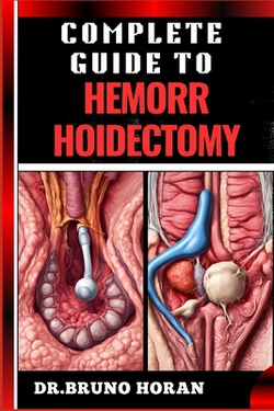 Complete Guide to Hemorrhoidectomy|Bruno Horan