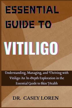 Essential Guide to Vitiligo|Casey Loren