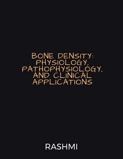 Bone Density|Dr Rashmi